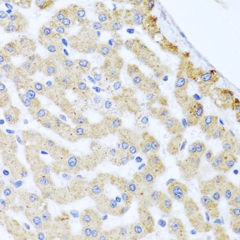 CETN3 Antibody