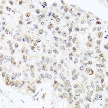 CETN3 Antibody