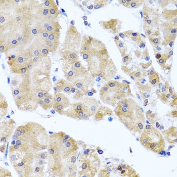 CETN3 Antibody