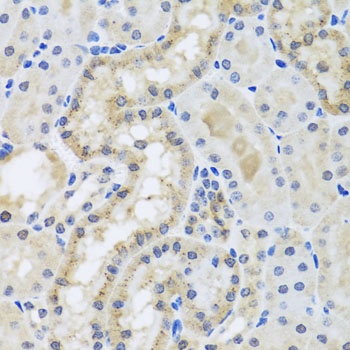 CETN3 Antibody