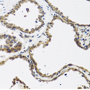 CALCB Antibody