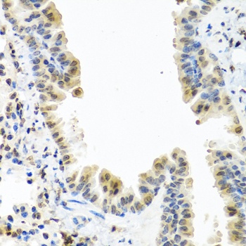 CALCB Antibody