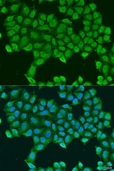 ATP5O Antibody
