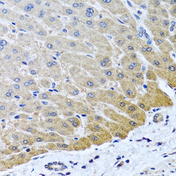 ARSF Antibody