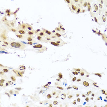 RAB3IP Antibody