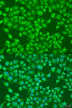 ACOX1 Antibody