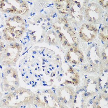 NEDD4L Antibody