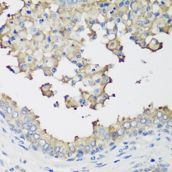 NEDD4L Antibody