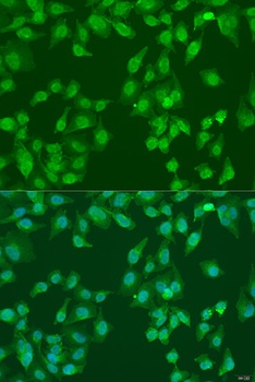 NEDD4L Antibody