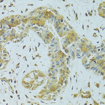 MTCH1 Antibody