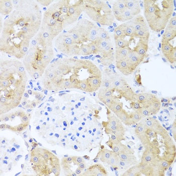 PDK3 Antibody