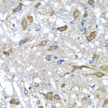 OSGEPL1 Antibody