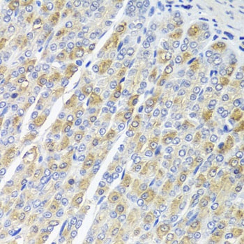 OSGEPL1 Antibody