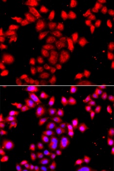OSGEPL1 Antibody