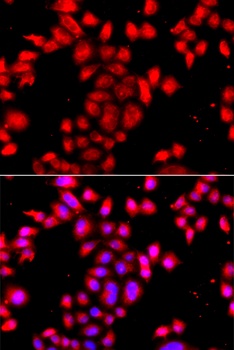 OSGEPL1 Antibody