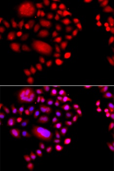POLR1D Antibody