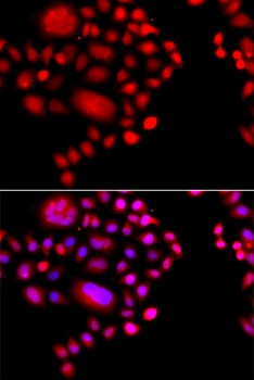 POLR1D Antibody