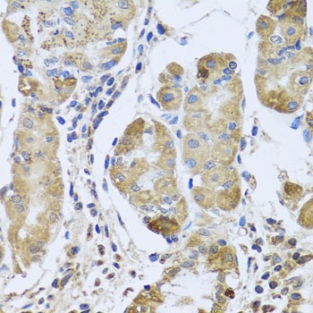 EFHC1 Antibody