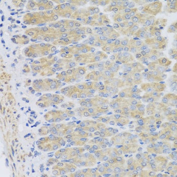 EFHC1 Antibody