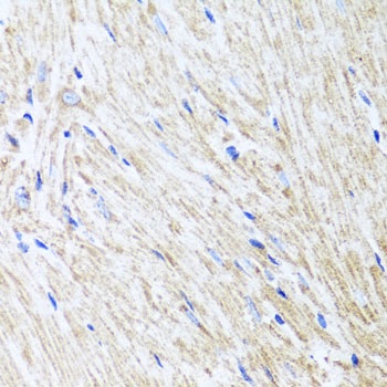 L2HGDH Antibody