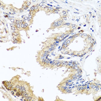 MCCC2 Antibody