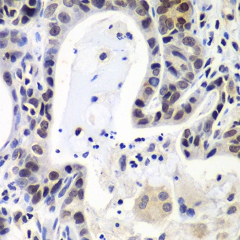 LSM2 Antibody