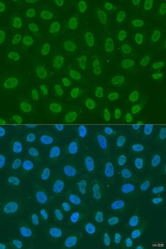 LSM2 Antibody