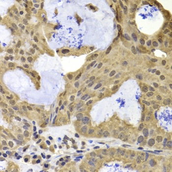 TERF2IP Antibody