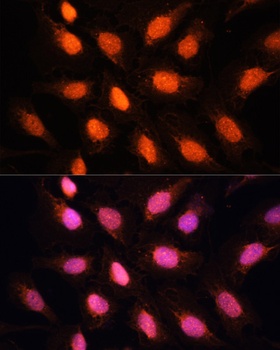 TERF2IP Antibody