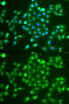 UCHL5 Antibody