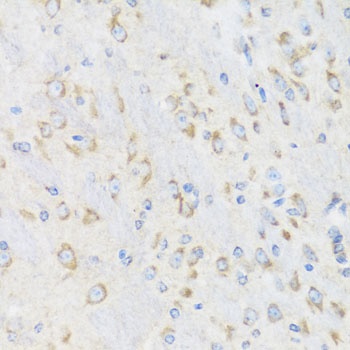 CHIC2 Antibody