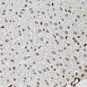 KDM4A Antibody