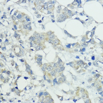 SOCS5 Antibody