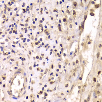 HDAC4 Antibody