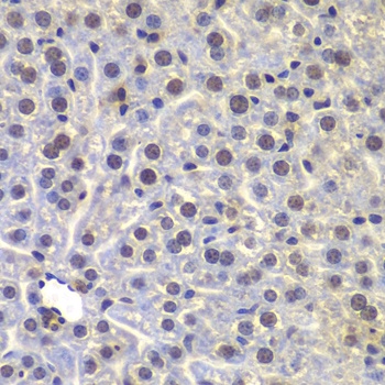 FUBP3 Antibody