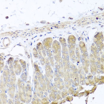 IRS2 Antibody
