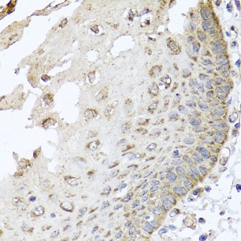IRS2 Antibody