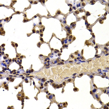 NSD2 Antibody