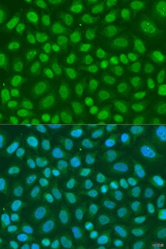 TAF11 Antibody