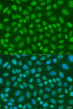 TAF11 Antibody