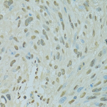 SAFB Antibody