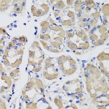 PSPH Antibody