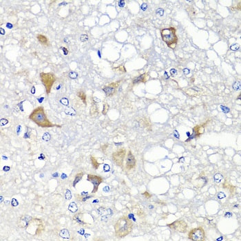 PSPH Antibody