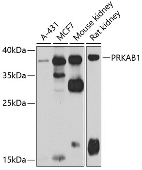 PRKAB1 Antibody