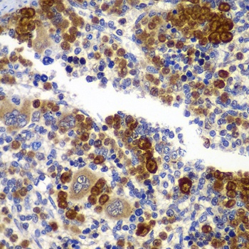 PRKAB1 Antibody