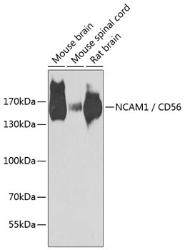 NCAM1 Antibody
