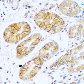 NCAM1 Antibody