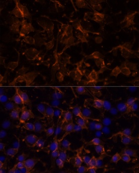 NCAM1 Antibody