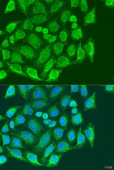 MTX1 Antibody