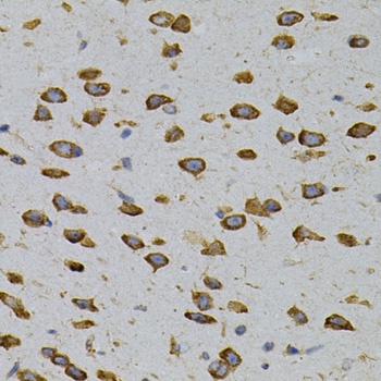CAPRIN1 Antibody